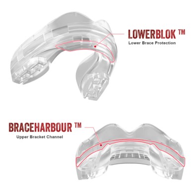 Protège-dents SafeJawz® Ortho Series Transparent - Taille Unique pour Appareils Dentaires